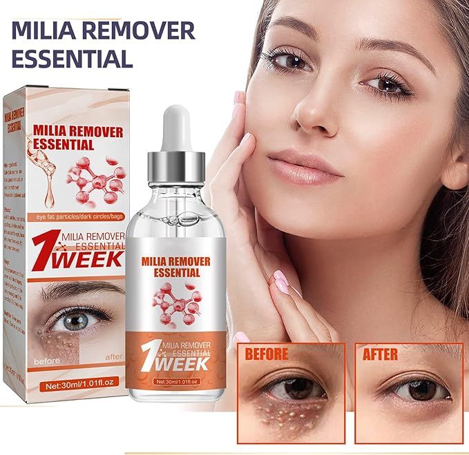 Smooth Milia Remover Serum (30ml)